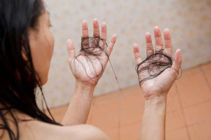 Hair,Falling,Out,In,Two,Hands,After,Rinse,Off,Shampoo.