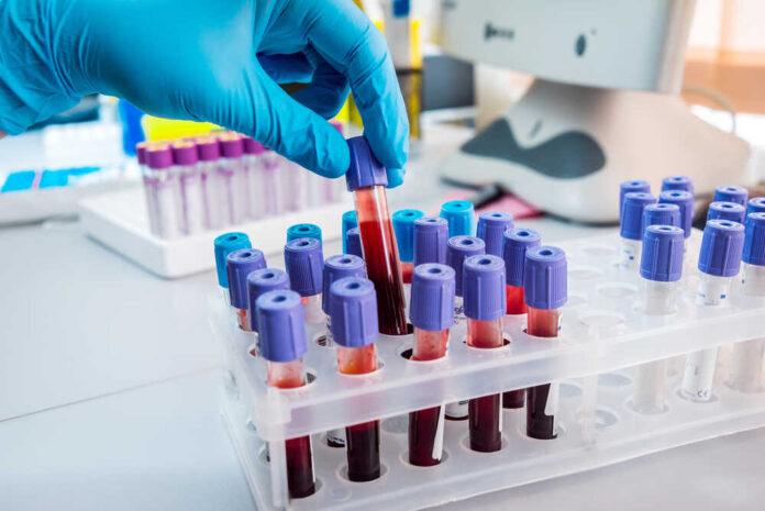 Medical,Equipment.,Blood,Test