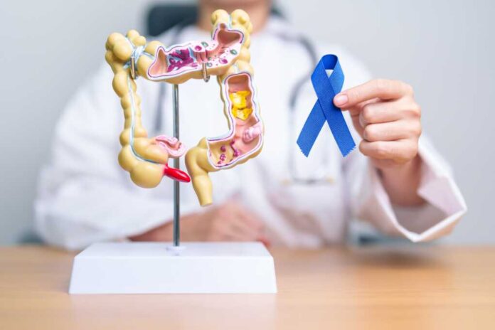 Doctor,Holding,Blue,Ribbon,With,Human,Colon,Anatomy,Model.,March