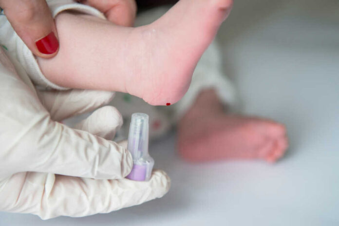 Nurse,Performing,The,Neonatal,Heel,Prick,Test
