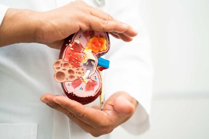Kidney,Disease,,Chronic,Kidney,Disease,Ckd,,Doctor,Hold,Model,To