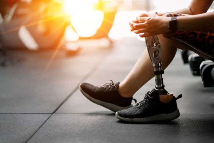 Prosthetic,,Artificial,Leg.,Woman,With,Prosthetic,Leg,Using,Walking,On